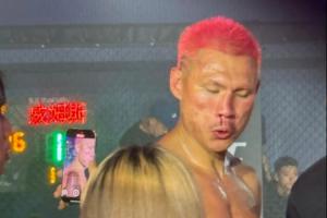 骨折了？恶鼠被威姆斯一拳打到面门！鼻梁已经出现严重歪斜！